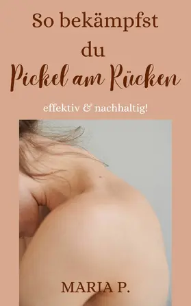 P. |  So bekämpfst du Pickel am Rücken effektiv und nachhaltig! | eBook | Sack Fachmedien