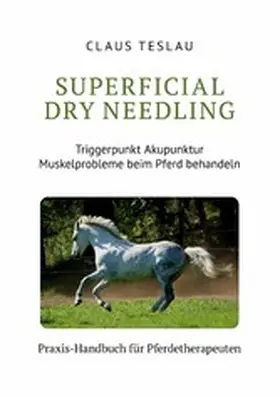 Teslau |  Superficial Dry Needling | eBook | Sack Fachmedien