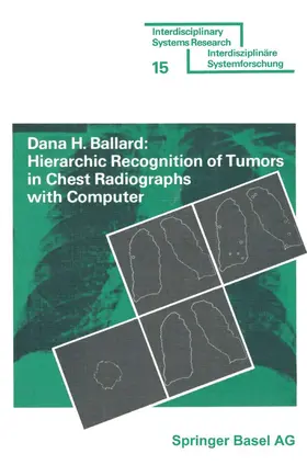 BALLARD | Hierarchic Recognition of Tumors in Chest Radiographs with Computer | Buch | 978-3-7643-0800-1 | www.sack.de