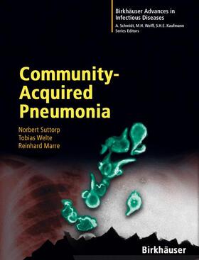 Suttorp / Welte / Marre |  Community-Acquired Pneumonia | Buch |  Sack Fachmedien