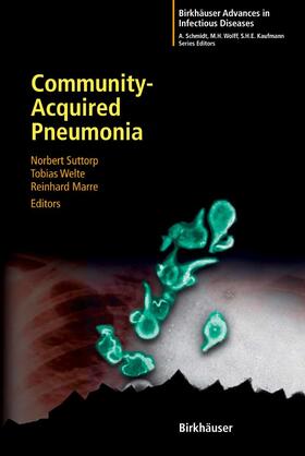 Suttorp / Welte / Marre | Community-Acquired Pneumonia | E-Book | sack.de