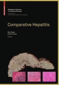 Weber / Protzer |  Comparative Hepatitis | Buch |  Sack Fachmedien
