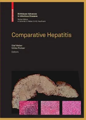 Weber / Schmidt / Protzer | Comparative Hepatitis | E-Book | sack.de