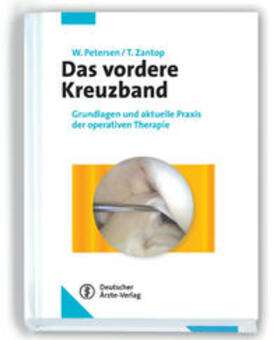 Petersen / Zantop | Das vordere Kreuzband | Buch | 978-3-7691-0562-9 | sack.de