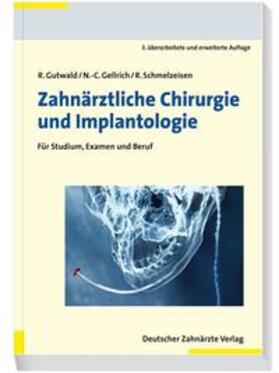 Gutwald / Gellrich / Schmelzeisen |  Zahnärztliche Chirurgie und Implantologie | Buch |  Sack Fachmedien