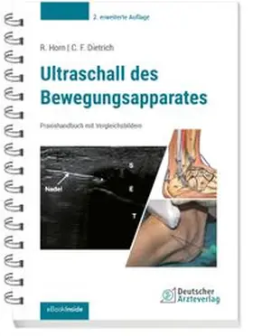 Horn / Dietrich | Ultraschall des Bewegungsapparates | E-Book | www.sack.de