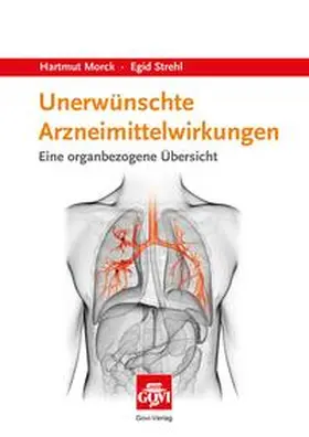 Morck / Strehl |  Unerwünschte Arzneimittelwirkungen | Buch |  Sack Fachmedien