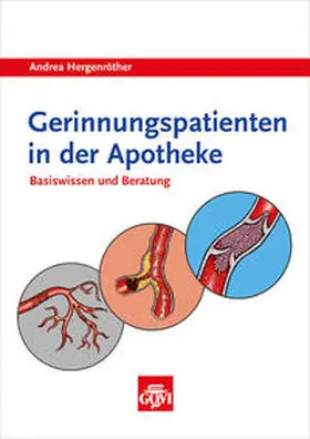 Hergenröther |  Gerinnungspatienten in der Apotheke | Buch |  Sack Fachmedien