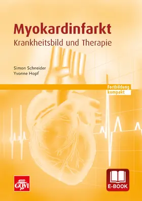 Schneider / Hopf |  Myokardinfarkt | eBook | Sack Fachmedien