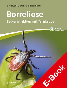 Fischer / Siegmund | Borreliose | E-Book | www.sack.de
