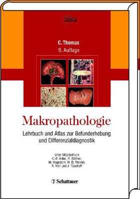 Thomas | Thomas, C: Makropathologie | Buch | 978-3-7945-2186-9 | sack.de