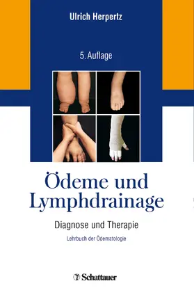 Herpertz | Ödeme und Lymphdrainage | Buch | 978-3-7945-2912-4 | www.sack.de