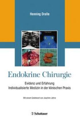 Dralle | Endokrine Chirurgie | Buch | sack.de