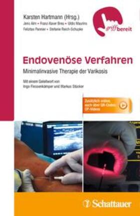 Alm / Hartmann / Breu |  Endovenöse Verfahren | Buch |  Sack Fachmedien