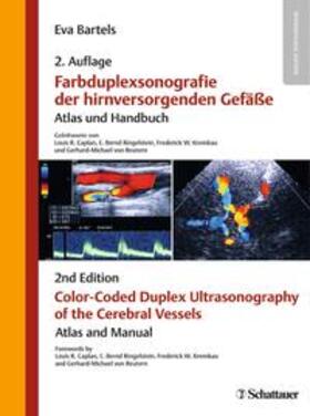 Bartels | Farbduplexsonografie der hirnversorgenden Gefäße / Color-Coded Duplex Ultrasonography of the Cerebral Vessels | Buch | 978-3-7945-3093-9 | sack.de