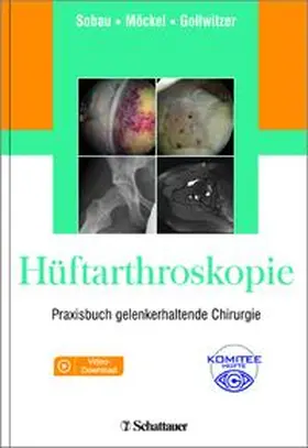Sobau / Möckel / Gollwitzer | Hüftarthroskopie | Buch | 978-3-7945-3184-4 | www.sack.de
