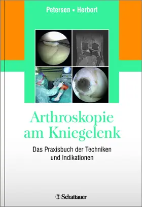 Petersen / Herbort |  Arthroskopie am Kniegelenk | Buch |  Sack Fachmedien