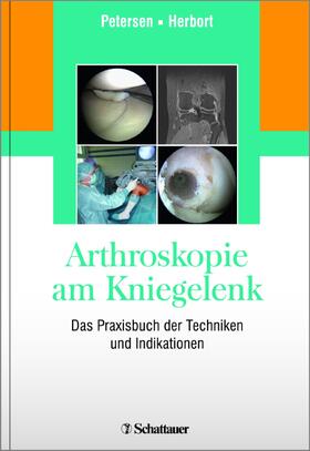 Petersen / Herbort | Arthroskopie am Kniegelenk | Buch | 978-3-7945-3217-9 | sack.de