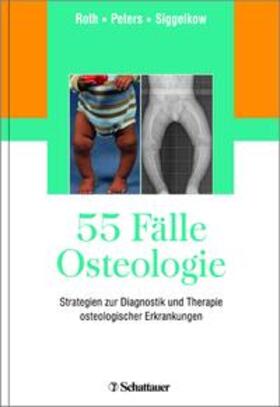 Roth / Peters / Siggelkow | 55 Fälle Osteologie | Buch | 978-3-7945-3220-9 | sack.de