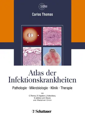 Thomas / Cecetka-Thomas / Woicichowski |  Atlas der Infektionskrankheiten | eBook | Sack Fachmedien