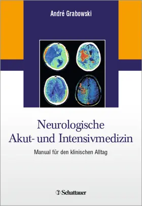 Grabowski |  Neurologische Akut- und Intensivmedizin | eBook | Sack Fachmedien