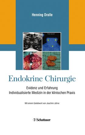 Dralle | Endokrine Chirurgie | E-Book | sack.de