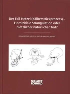 Madea |  Der Fall Hetzel (Kälberstrickprozess) - Homizidale Strangulation oder plötzlicher natürlicher Tod? | Buch |  Sack Fachmedien