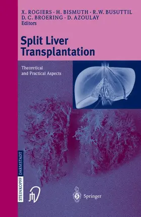 Rogiers / Bismuth / Azoulay |  Split liver transplantation | Buch |  Sack Fachmedien