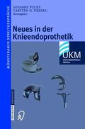 Fuchs / Tibesku |  Neues in der Knieendoprothetik | Buch |  Sack Fachmedien