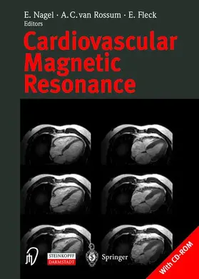 Nagel / Rossum / Fleck |  Cardiovascular Magnetic Resonance | Buch |  Sack Fachmedien