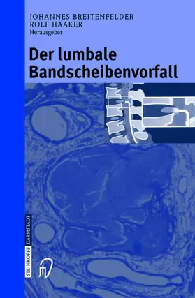 Breitenfelder / Haaker |  Der lumbale Bandscheibenvorfall | Buch |  Sack Fachmedien