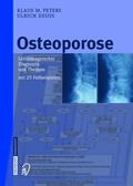 Peters / Deuß |  Osteoporose | Buch |  Sack Fachmedien