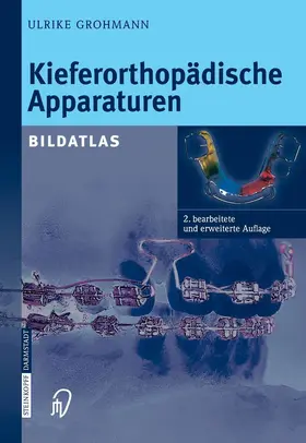 Grohmann |  Kieferorthopädische Apparaturen | eBook | Sack Fachmedien
