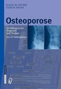 Peters / Deuß |  Osteoporose | eBook | Sack Fachmedien
