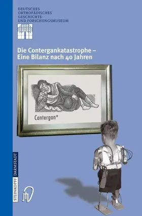 Zichner / Rauschmann / Thomann |  Die Contergankatastrophe - Eine Bilanz nach 40 Jahren | eBook | Sack Fachmedien