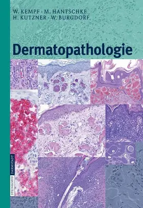 Kempf / Hantschke / Kutzner |  Dermatopathologie | eBook | Sack Fachmedien