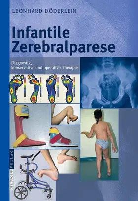 Döderlein |  Infantile Zerebralparese | eBook | Sack Fachmedien
