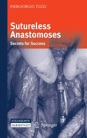 Tozzi | Sutureless Anastomoses | E-Book | www.sack.de