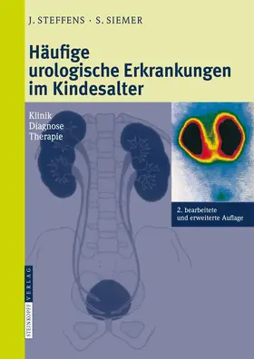 Steffens / Siemer |  Häufige urologische Erkrankungen im Kindesalter | Buch |  Sack Fachmedien