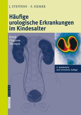 Siemer / Steffens | Häufige urologische Erkrankungen im Kindesalter | Buch | 978-3-7985-1780-6 | sack.de