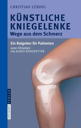 Lüring |  Künstliche Kniegelenke | eBook | Sack Fachmedien