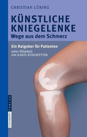 Lüring | Künstliche Kniegelenke | E-Book | sack.de