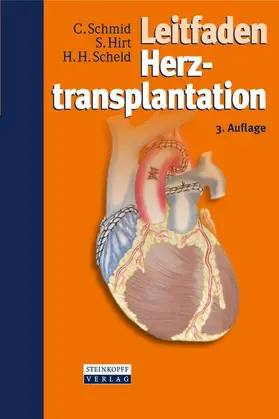 Schmid / Hirt / Scheld |  Leitfaden Herztransplantation | Buch |  Sack Fachmedien