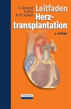 Schmid / Hirt / Scheld |  Leitfaden Herztransplantation | eBook | Sack Fachmedien