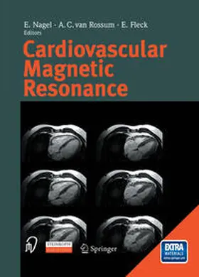 Nagel / Rossum / Fleck |  Cardiovascular Magnetic Resonance | eBook | Sack Fachmedien