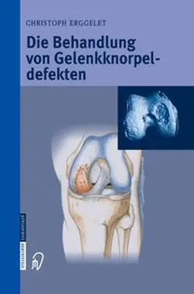 Erggelet |  Die Behandlung von Gelenkknorpeldefekten | eBook | Sack Fachmedien