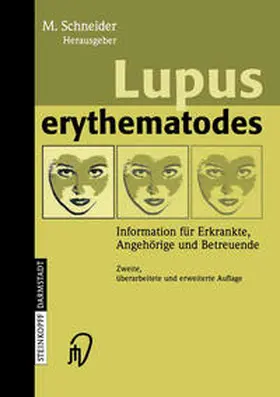 Schneider |  Lupus erythematodes | eBook | Sack Fachmedien