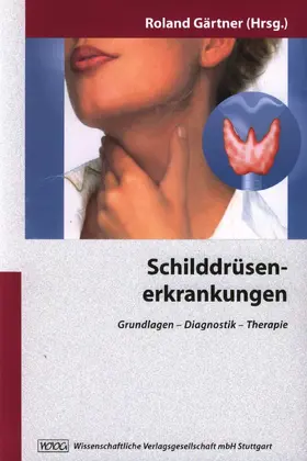 Gärtner |  Schilddrüsenerkrankungen | Buch |  Sack Fachmedien
