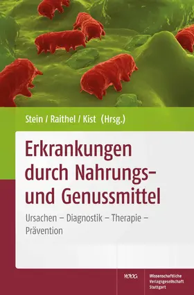 Stein / Kist / Raithel |  Erkrankungen durch Nahrungs- und Genussmittel | eBook | Sack Fachmedien