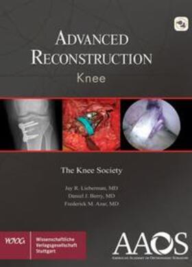 Lieberman / Berry / Azar | AAOS Advanced Reconstruction Knee | E-Book | sack.de